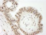 Topo II Beta Antibody in Immunohistochemistry (IHC)