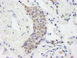 Topo II Beta Antibody in Immunohistochemistry (IHC)