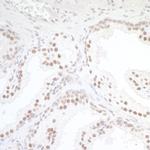 TORC1 Antibody in Immunohistochemistry (IHC)