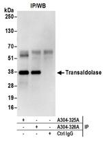 Transaldolase Antibody in Western Blot (WB)