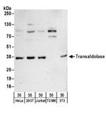 Transaldolase Antibody in Western Blot (WB)