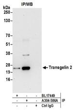 Transgelin 2 Antibody in Western Blot (WB)