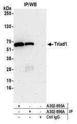 Triad1 Antibody in Western Blot (WB)