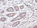 Trim33 Antibody in Immunohistochemistry (Paraffin) (IHC (P))