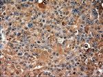 Trim33 Antibody in Immunohistochemistry (Paraffin) (IHC (P))