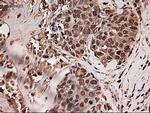 Trim33 Antibody in Immunohistochemistry (Paraffin) (IHC (P))