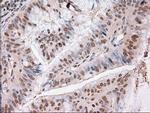 Trim33 Antibody in Immunohistochemistry (Paraffin) (IHC (P))