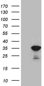 U2AF1L4 Antibody in Western Blot (WB)