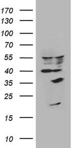 U2AF1L4 Antibody in Western Blot (WB)