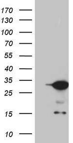 U2AF1L4 Antibody in Western Blot (WB)