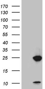 U2AF1L4 Antibody in Western Blot (WB)