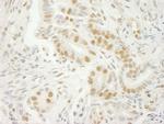 U2AF35 Antibody in Immunohistochemistry (IHC)