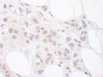 U2AF65 Antibody in Immunohistochemistry (IHC)