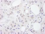 U2AF65 Antibody in Immunohistochemistry (IHC)