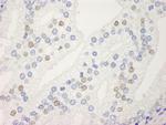 UACA Antibody in Immunohistochemistry (IHC)