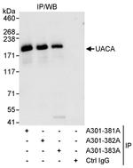 UACA Antibody in Immunoprecipitation (IP)