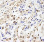 UACA Antibody in Immunohistochemistry (IHC)