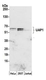 UAP1 Antibody in Western Blot (WB)