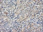 UBA2 Antibody in Immunohistochemistry (Paraffin) (IHC (P))