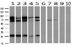 UBA2 Antibody in Western Blot (WB)