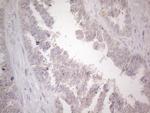 UBA52 Antibody in Immunohistochemistry (Paraffin) (IHC (P))