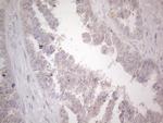 UBA52 Antibody in Immunohistochemistry (Paraffin) (IHC (P))