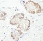 UBCH7 Antibody in Immunohistochemistry (IHC)