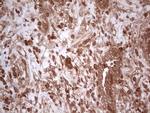 UBE2D2 Antibody in Immunohistochemistry (Paraffin) (IHC (P))