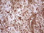 UBE2D2 Antibody in Immunohistochemistry (Paraffin) (IHC (P))