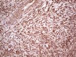 UBE2D2 Antibody in Immunohistochemistry (Paraffin) (IHC (P))