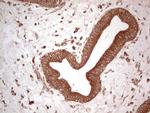 UBE2D2 Antibody in Immunohistochemistry (Paraffin) (IHC (P))