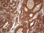 UBE2D2 Antibody in Immunohistochemistry (Paraffin) (IHC (P))