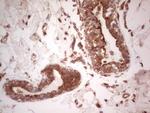 UBE2D2 Antibody in Immunohistochemistry (Paraffin) (IHC (P))