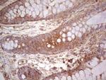 UBE2D2 Antibody in Immunohistochemistry (Paraffin) (IHC (P))