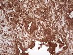 UBE2D2 Antibody in Immunohistochemistry (Paraffin) (IHC (P))