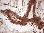 UBE2D2 Antibody in Immunohistochemistry (Paraffin) (IHC (P))