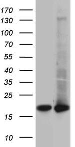 UBE2D4 Antibody in Western Blot (WB)