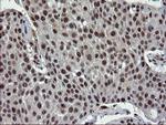 UBE2E3 Antibody in Immunohistochemistry (Paraffin) (IHC (P))