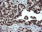 UBE2E3 Antibody in Immunohistochemistry (Paraffin) (IHC (P))