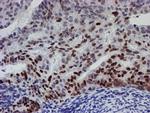 UBE2E3 Antibody in Immunohistochemistry (Paraffin) (IHC (P))