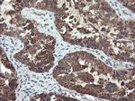 UBE2E3 Antibody in Immunohistochemistry (Paraffin) (IHC (P))