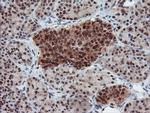 UBE2E3 Antibody in Immunohistochemistry (Paraffin) (IHC (P))