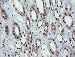 UBE2E3 Antibody in Immunohistochemistry (Paraffin) (IHC (P))