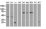 UBE2E3 Antibody in Western Blot (WB)