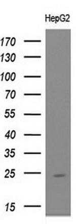 UBE2E3 Antibody in Western Blot (WB)