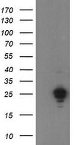 UBE2E3 Antibody in Western Blot (WB)