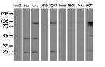 UBE2E3 Antibody in Western Blot (WB)