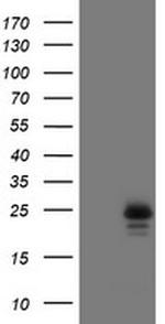 UBE2E3 Antibody in Western Blot (WB)