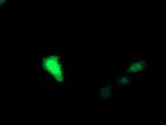 UBE2G2 Antibody in Immunocytochemistry (ICC/IF)