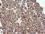 UBE2G2 Antibody in Immunohistochemistry (Paraffin) (IHC (P))